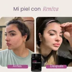 Colágeno Hidrolizado con Biopeptidos Activos Renova+ - Imagen 6